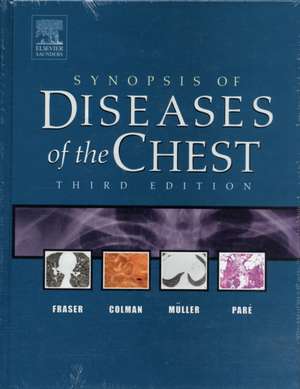 Synopsis of Diseases of the Chest de Richard S. Fraser