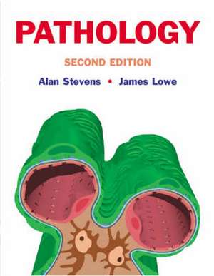 Pathology: Illustrated Review in Colour de Alan Stevens