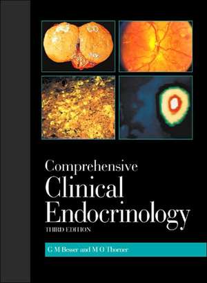 Comprehensive Clinical Endocrinology: Including CD-ROM de G. Michael Besser