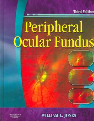 Peripheral Ocular Fundus de William L. Jones