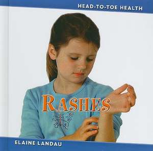 Rashes de Elaine Landau