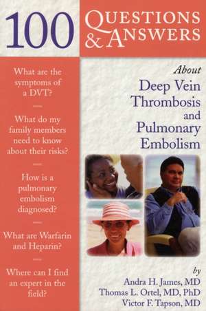 100 Questions & Answers about Deep Vein Thrombosis and Pulmonary Embolism de Andra H. James