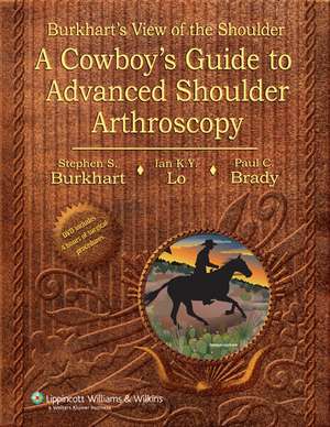 Burkhart's View of the Shoulder: A Cowboy's Guide to Advanced Shoulder Arthroscopy de Stephen S. Burkhart MD