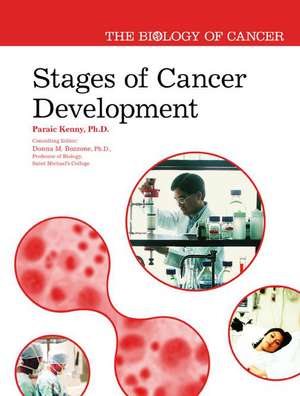 Stages of Cancer Development de Paraic Kenny