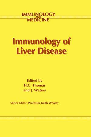 Immunology of Liver Disease de H.C. Thomas