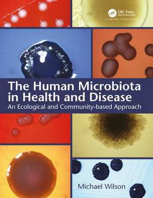 The Human Microbiota in Health and Disease: An Ecological and Community-based Approach de Michael Wilson