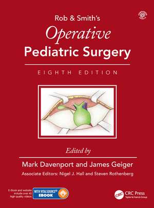 Operative Pediatric Surgery de Mark Davenport