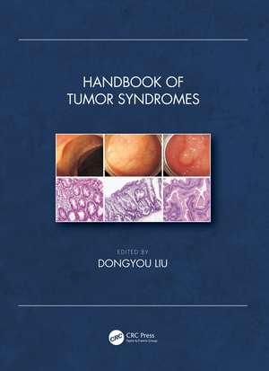 Handbook of Tumor Syndromes de Dongyou Liu