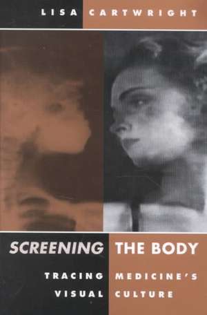 Screening The Body: Tracing Medicine’s Visual Culture de Lisa Cartwright