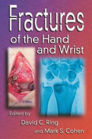 Fractures of the Hand and Wrist de David C. Ring