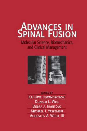 Advances in Spinal Fusion: Molecular Science, BioMechanics, and Clinical Management de Kai-Uwe Lewandrowski