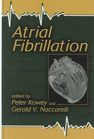 Atrial Fibrillation de Peter Kowey