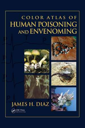 Color Atlas of Human Poisoning and Envenoming de Diaz James