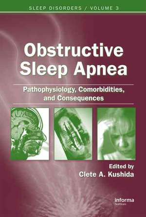 Obstructive Sleep Apnea: Pathophysiology, Comorbidities and Consequences: Pathophysiology, Comorbidities, and Consequences de Clete A. Kushida