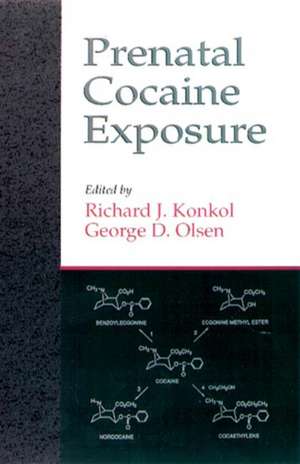 Prenatal Cocaine Exposure de Richard J. Konkol