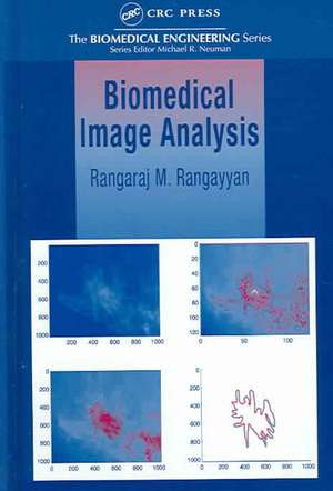 Biomedical Image Analysis de Rangaraj M. Rangayyan