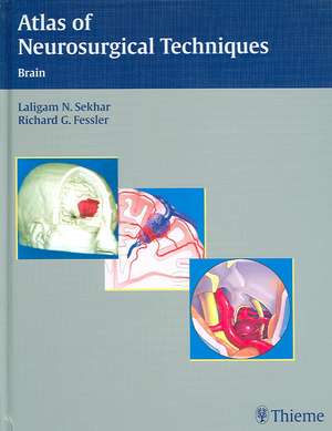 Atlas of Neurosurgical Techniques: Brain de Laligam N. Sekhar