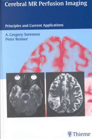 Cerebral MR Perfusion Imaging: Book + CD-ROM Set: Principles and Current Applications de A. Gregory Sorensen