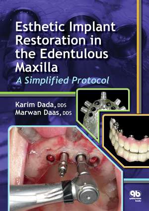 Esthetic Implant Restoration in the Edentulous Maxilla: A Simplified Protocol de Karim Dada