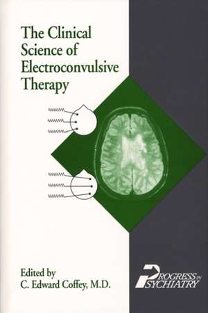 Clinical Science of Electroconvulsive Therapy