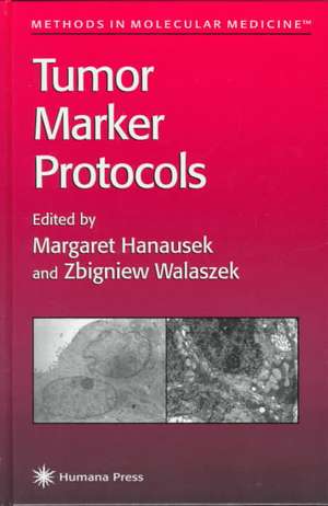 Tumor Marker Protocols de Margaret Hanausek