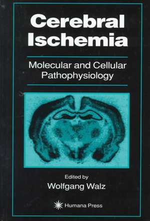 Cerebral Ischemia: Molecular and Cellular Pathophysiology de Wolfgang Walz