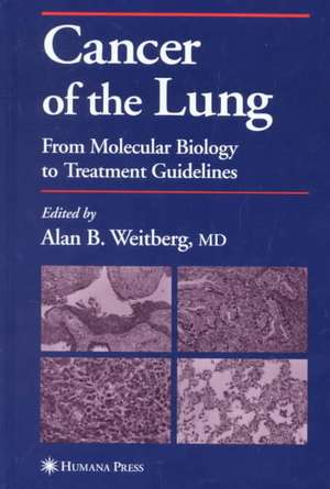 Cancer of the Lung: From Molecular Biology to Treatment Guidelines de Alan Weitberg