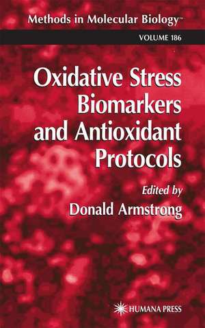 Oxidative Stress Biomarkers and Antioxidant Protocols de Donald Armstrong