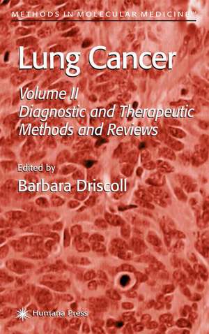 Lung Cancer: Volume 2: Diagnostic and Therapeutic Methods and Reviews de Barbara Driscoll