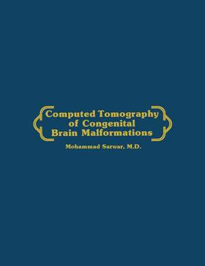 Computed Tomography of Congenital Brain Malformations de Mohammed Sarwar