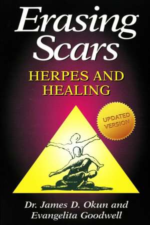 Erasing Scars de James D Okun