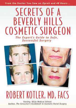 Secrets of a Beverly Hills Cosmetic Surgeon: The Expert's Guide to Safe, Successful Surgery de Robert Kotler