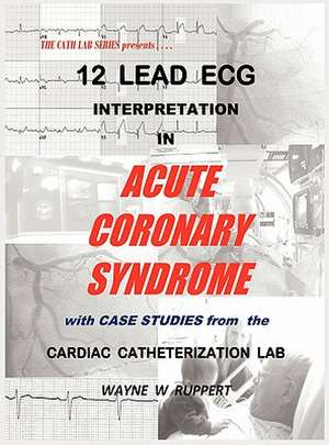 12 Lead ECG Interpretation in Acute Coronary Syndrome with Case Studies from the Cardiac Catheterization Lab de Wayne W Ruppert