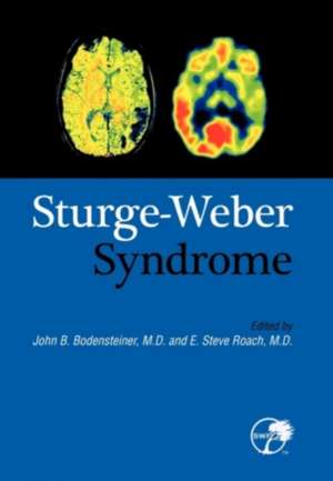 Sturge-Weber Syndrome de John B. Bodensteiner