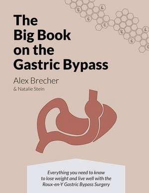 The Big Book on the Gastric Bypass de Alex Brecher