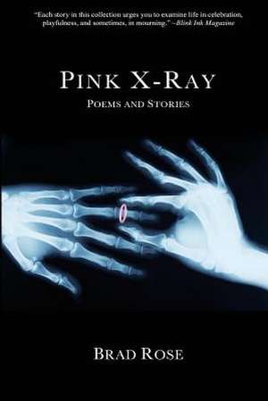 Pink X-Ray de Brad Rose