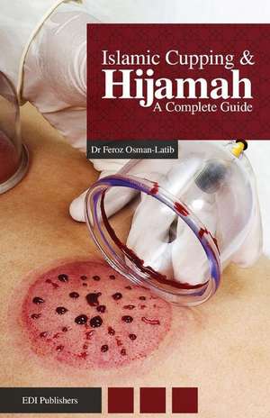 Islamic Cupping & Hijamah de Dr Feroz Osman-Latib