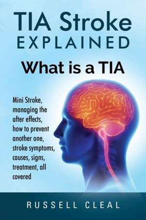 Tia Stroke Explained de Russell Cleal