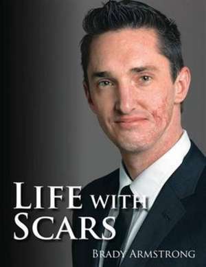 Life with Scars: A Guide to Emotionally Overcoming Physical Trauma de Brady K. Armstrong