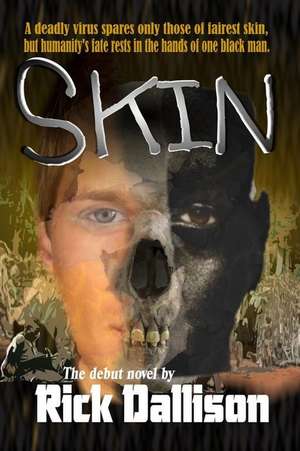 Skin de Rick Dallison