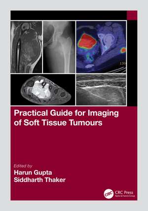 Practical Guide for Imaging of Soft Tissue Tumours de Harun Gupta