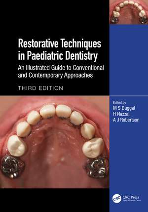 Restorative Techniques in Paediatric Dentistry: An Illustrated Guide to Conventional and Contemporary Approaches de M S Duggal