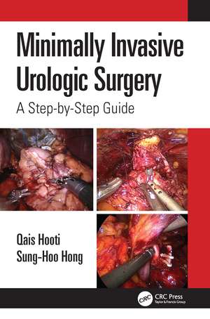 Minimally Invasive Urologic Surgery: A Step-by-Step Guide de Qais Hooti