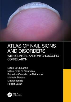 Atlas of Nail Signs and Disorders with Clinical and Onychoscopic Correlation de Nilton Di Chiacchio