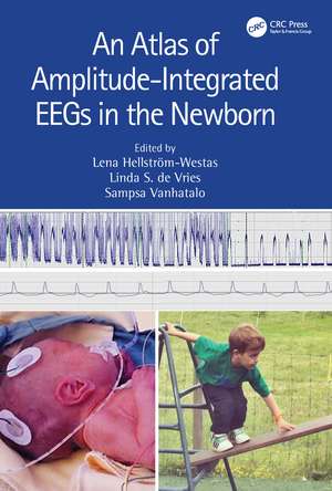 An Atlas of Amplitude-Integrated EEGs in the Newborn de Linda S de Vries