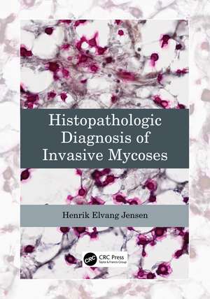 Histopathologic Diagnosis of Invasive Mycoses de Henrik Elvang Jensen