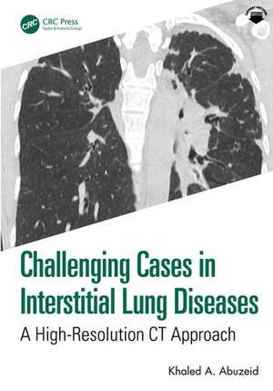 Challenging Cases in Interstitial Lung Diseases de Khaled A. Abuzeid