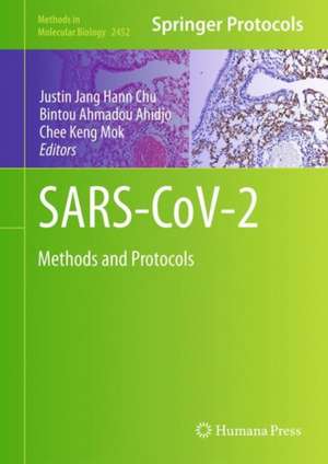 SARS-CoV-2: Methods and Protocols de Justin Jang Hann Chu