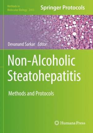 Non-Alcoholic Steatohepatitis: Methods and Protocols de Devanand Sarkar