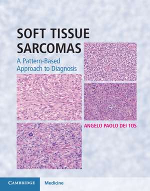 Soft Tissue Sarcomas Hardback with Online Resource: A Pattern-Based Approach to Diagnosis de Angelo Paolo Dei Tos